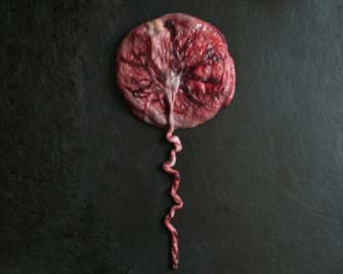 Nageboorte; het derde tijdperk van de bevalling