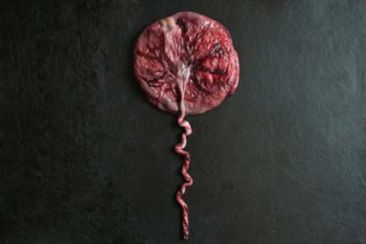 Placenta