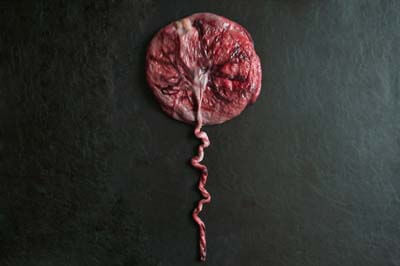 Placenta