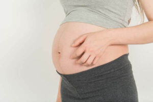 zwangerschapsjeuk_1050935060 Zwangerschapsjeuk