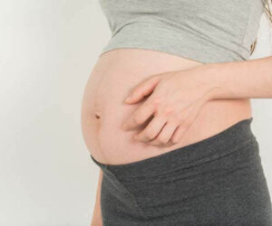 Zwangerschapsjeuk; wat is het en wat kun je er aan doen?