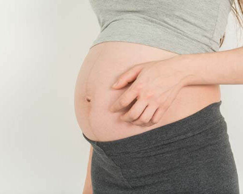 Zwangerschapsjeuk; wat is het en wat kun je er aan doen?