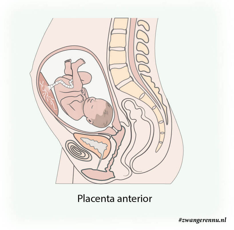 Illustratie Placenta anterior