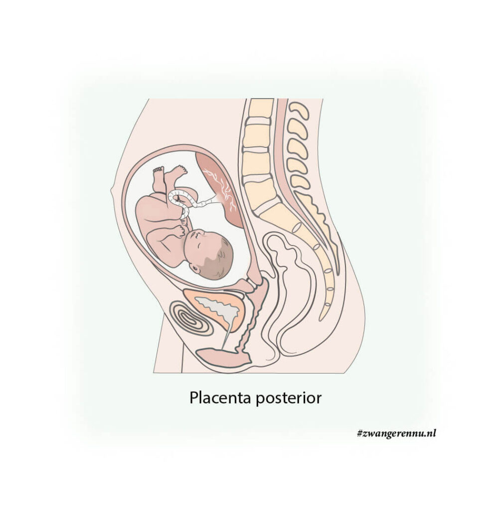 Illustratie Placenta posterior