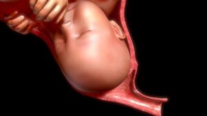 Ontsluiting; het eerste tijdperk van de bevalling