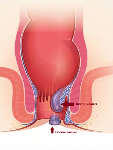 illustratie aambei klein