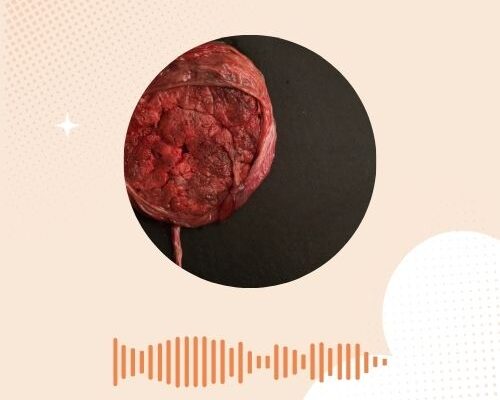 De bevalling: het derde tijdperk ( de nageboorte)