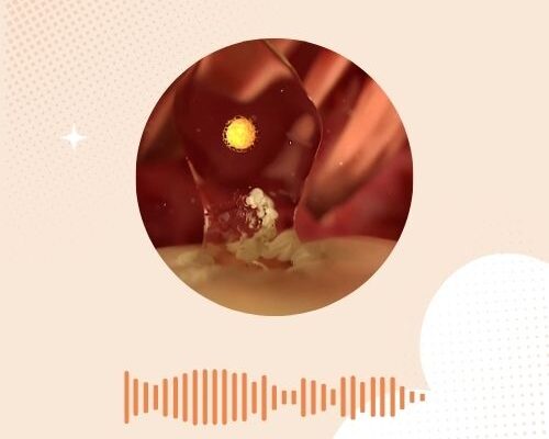 Ovulatiepijn: wat voel je en wat kun je ertegen doen?