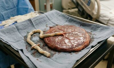 placenta