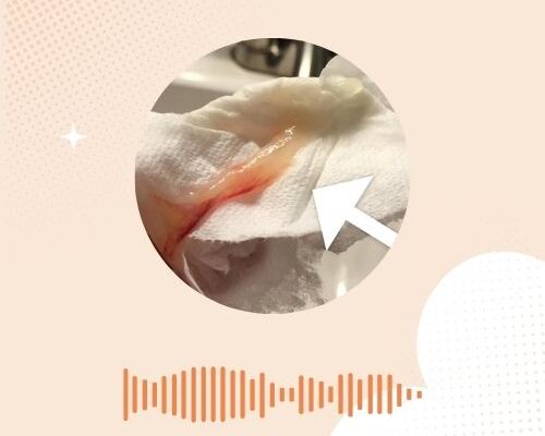 Slijmprop verloren: begint de bevalling nu?