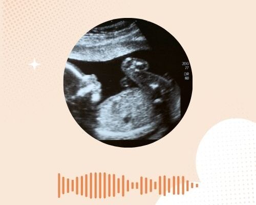 NUB-theorie: het geslacht van je baby voorspellen bij 12 weken?
