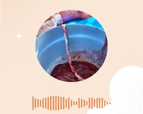 Een achtergebleven placentarest, wat als de bevalling nog niet klaar is?