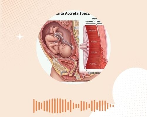 Wat als de placenta weigert los te laten? Alles over Placenta accreta